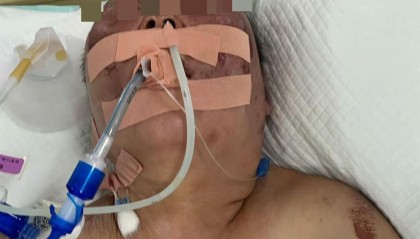 被前夫打进ICU的女子情况仍不稳定，其8岁女儿也曾遭父亲扇脸，律师：已构成故意伤害罪，或同时涉虐待罪